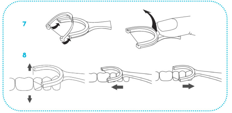 cybersonic pre-strung floss diagram