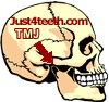 TemporoMandibular Joint (TMJ) products at Just4teeth.com